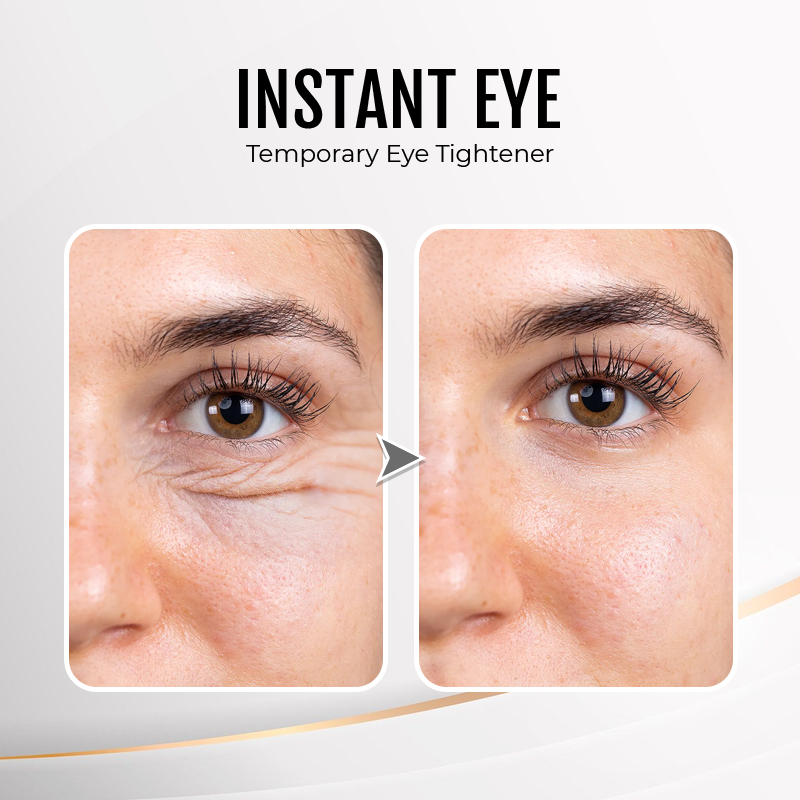 🔥 Last Day Discount:80% OFF💐Instant Temporary Face Tightener