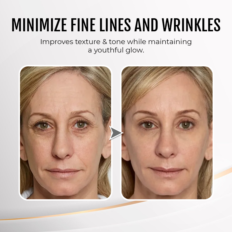 🔥 Last Day Discount:80% OFF💐Instant Temporary Face Tightener