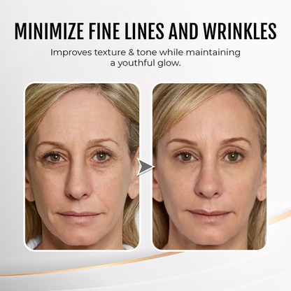 🔥 Last Day Discount:80% OFF💐Instant Temporary Face Tightener