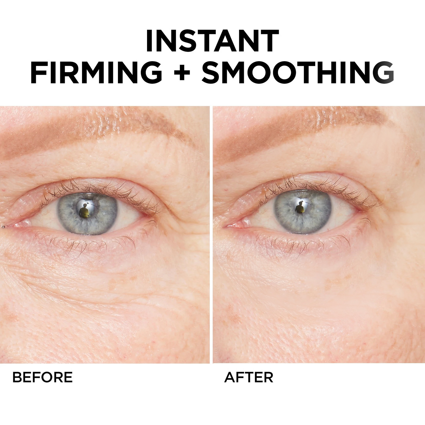 🔥 Last Day Discount:80% OFF💐Instant Temporary Face Tightener
