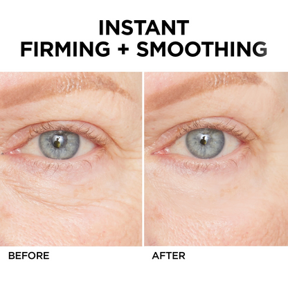 🔥 Last Day Discount:80% OFF💐Instant Temporary Face Tightener