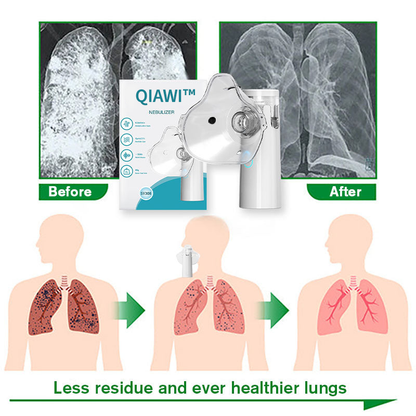 QIAWI™ 👑 Clear Lung Nebulizer - For clear lungs and free breathing 🌿💨