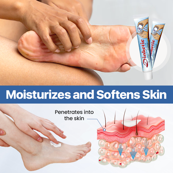 LOVILDS™ VitaGluco Diabetes Treatment Cream -👨‍⚕️ American Academy of Dermatology (AAD) Approved